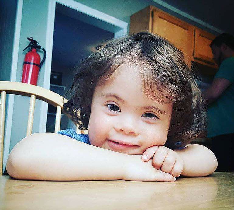 Asbf Dancing for Down Syndrome